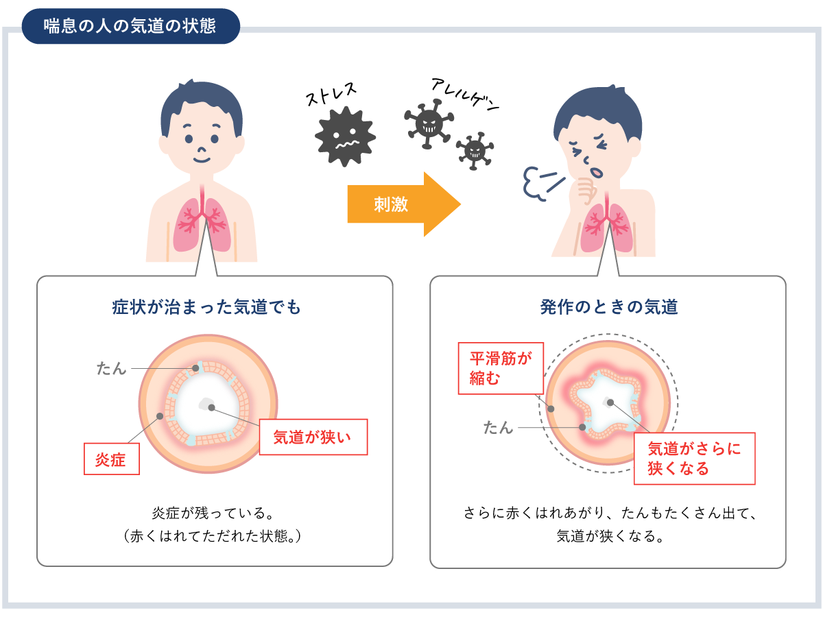 運動誘発喘息と運動療法