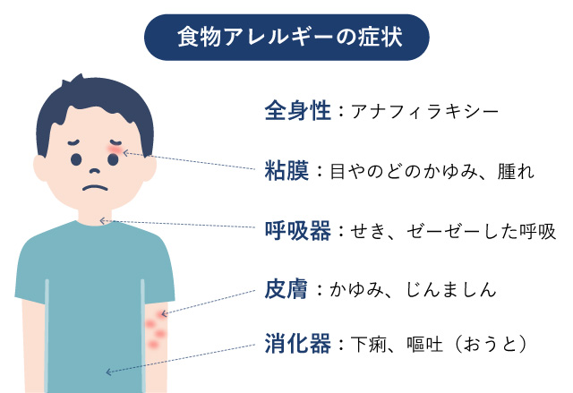 食物アレルギーについて 診療について 荒木小児科医院